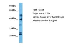 ZFP41 Rabbit anti-Human, Polyclonal, Novus Biologicals 0.1ml; Unconjugated:Antibodies,